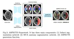 Deep-ASPECTS: A Segmentation-Assisted Model for Stroke Severity Measurement